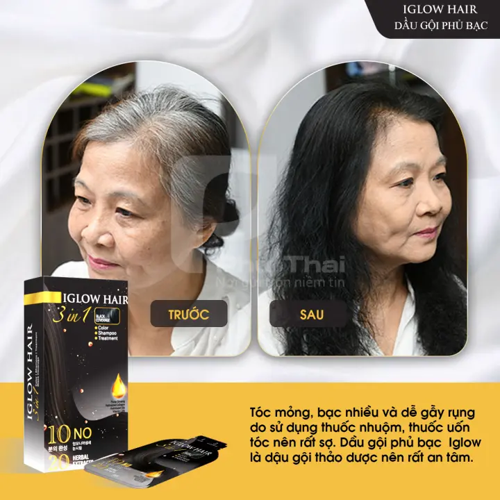 feedback iglow hair - review iglow hair - iglow hair có tốt không - iglow hair có hiệu quả không - 1market.com.vn - 11