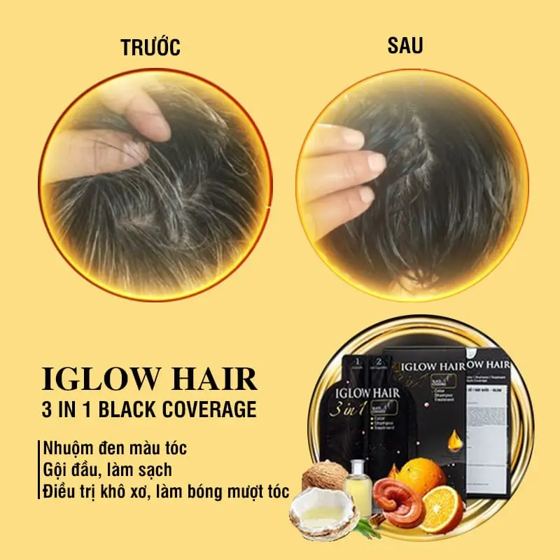 feedback iglow hair - review iglow hair - iglow hair có tốt không - iglow hair có hiệu quả không - 1market.com.vn - 2