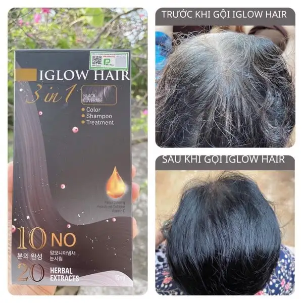 feedback iglow hair - review iglow hair - iglow hair có tốt không - iglow hair có hiệu quả không - 1market.com.vn - 3