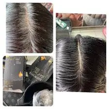 feedback iglow hair - review iglow hair - iglow hair có tốt không - iglow hair có hiệu quả không - 1market.com.vn - 4