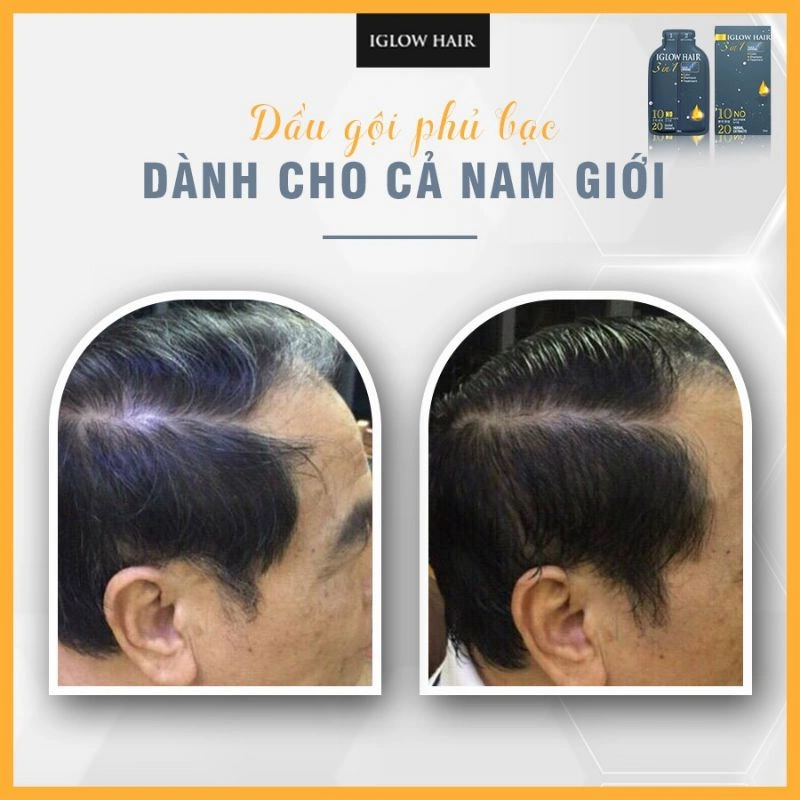 feedback iglow hair - review iglow hair - iglow hair có tốt không - iglow hair có hiệu quả không - 1market.com.vn - 8