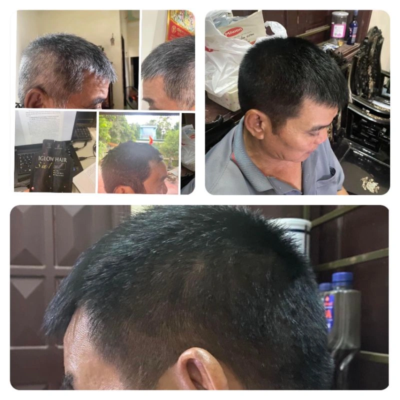 feedback iglow hair - review iglow hair - iglow hair có tốt không - iglow hair có hiệu quả không - 1market.com.vn - 9